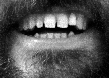 nate beaty's teeth